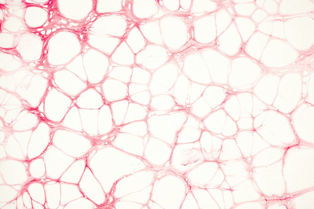 Top 10 High-Yield Pathology Concepts (With Mnemonics)