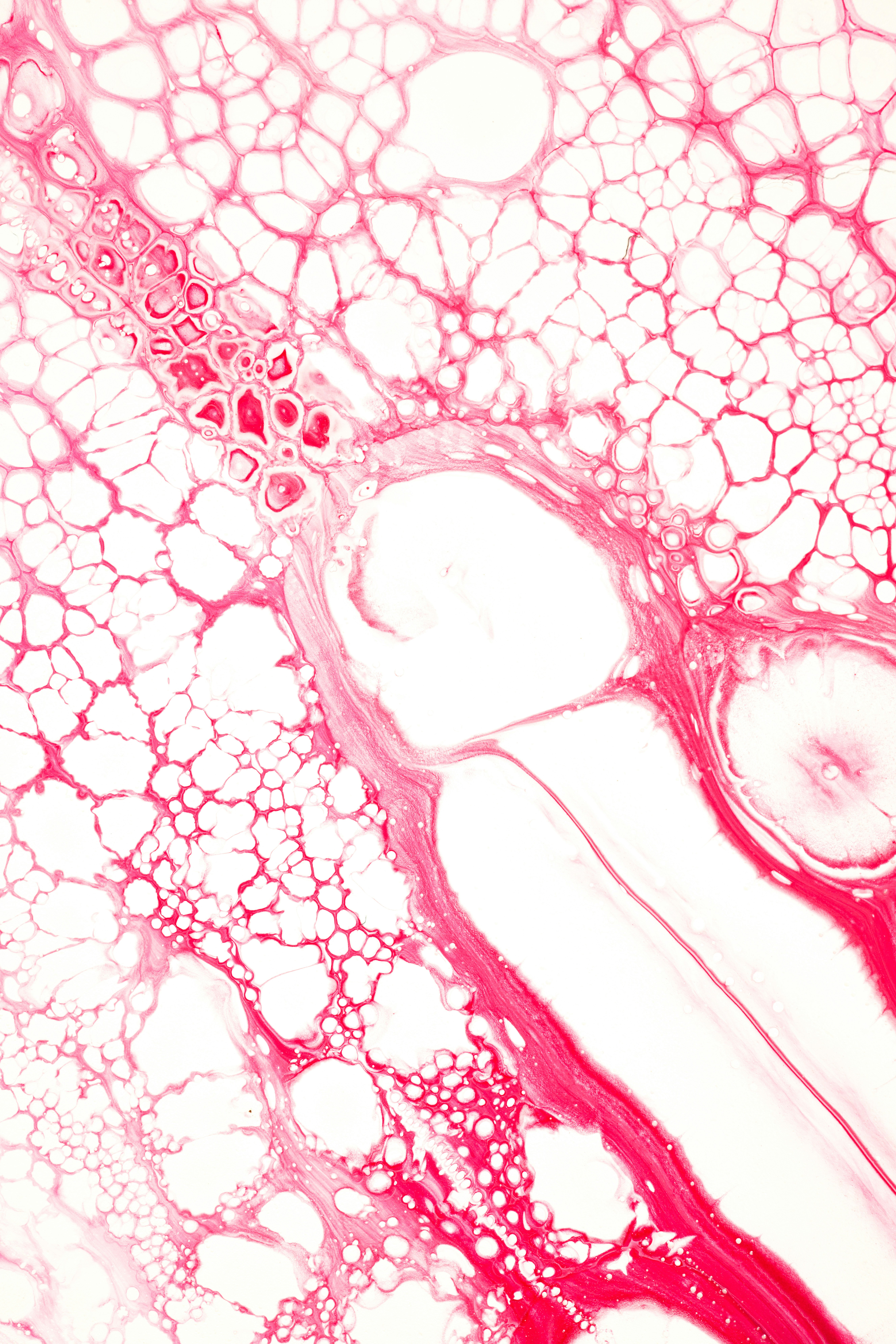 טיפול בהקזת דם – שיטה עתיקה לשחרור, ניקוי וריפוי טבעי