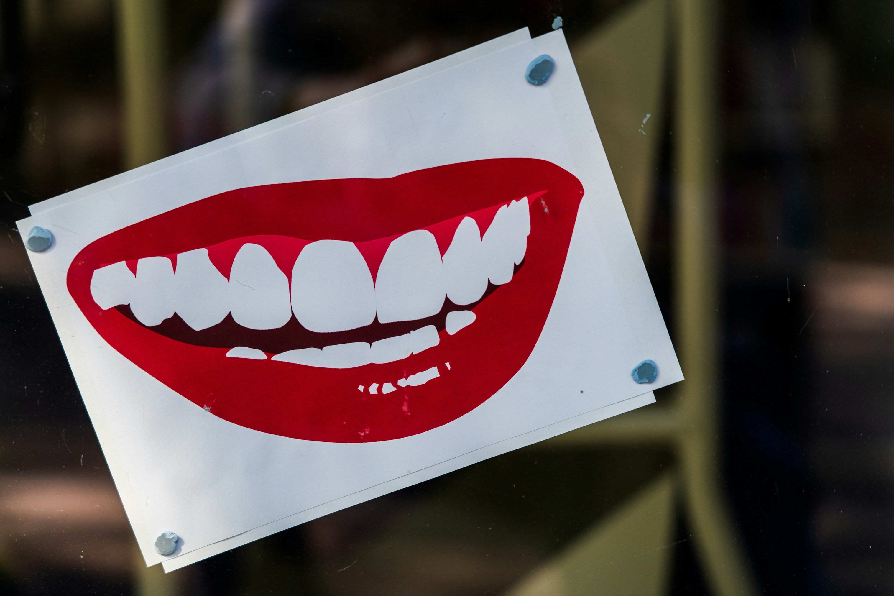 Is Teeth Whitening Suitable For Individuals With Dental Implants Or Bridges?