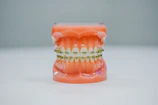 Full jaw dental model displayed on a clean white background.