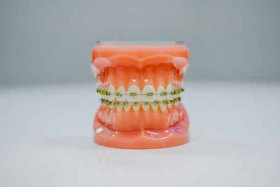 A realistic dental model displaying a full set of teeth fitted with orthodontic braces. The model is placed against a plain background, highlighting the intricate details of the braces and the gums.