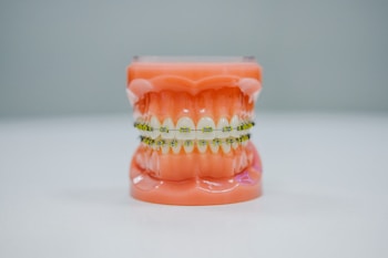 A realistic dental model displaying a full set of teeth fitted with orthodontic braces. The model is placed against a plain background, highlighting the intricate details of the braces and the gums.