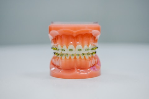 A realistic dental model displaying a full set of teeth fitted with orthodontic braces. The model is placed against a plain background, highlighting the intricate details of the braces and the gums.