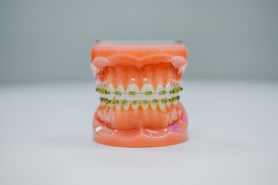A realistic dental model displaying a full set of teeth fitted with orthodontic braces. The model is placed against a plain background, highlighting the intricate details of the braces and the gums.