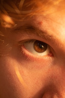 A close-up view of a human eye with light brown iris and visible eyelashes. The skin around the eye is illuminated with warm, golden light, highlighting fine hair and skin texture. There are subtle freckles and a small blemish visible on the skin.