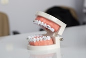 A dental model displaying a set of human teeth fitted with metal orthodontic braces. The teeth and gums are made from a synthetic material, mounted on a hinged frame, designed to simulate the human mouth.