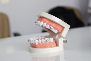 A dental model displaying a set of human teeth fitted with metal orthodontic braces. The teeth and gums are made from a synthetic material, mounted on a hinged frame, designed to simulate the human mouth.