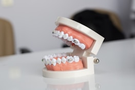A dental model displaying a set of human teeth fitted with metal orthodontic braces. The teeth and gums are made from a synthetic material, mounted on a hinged frame, designed to simulate the human mouth.