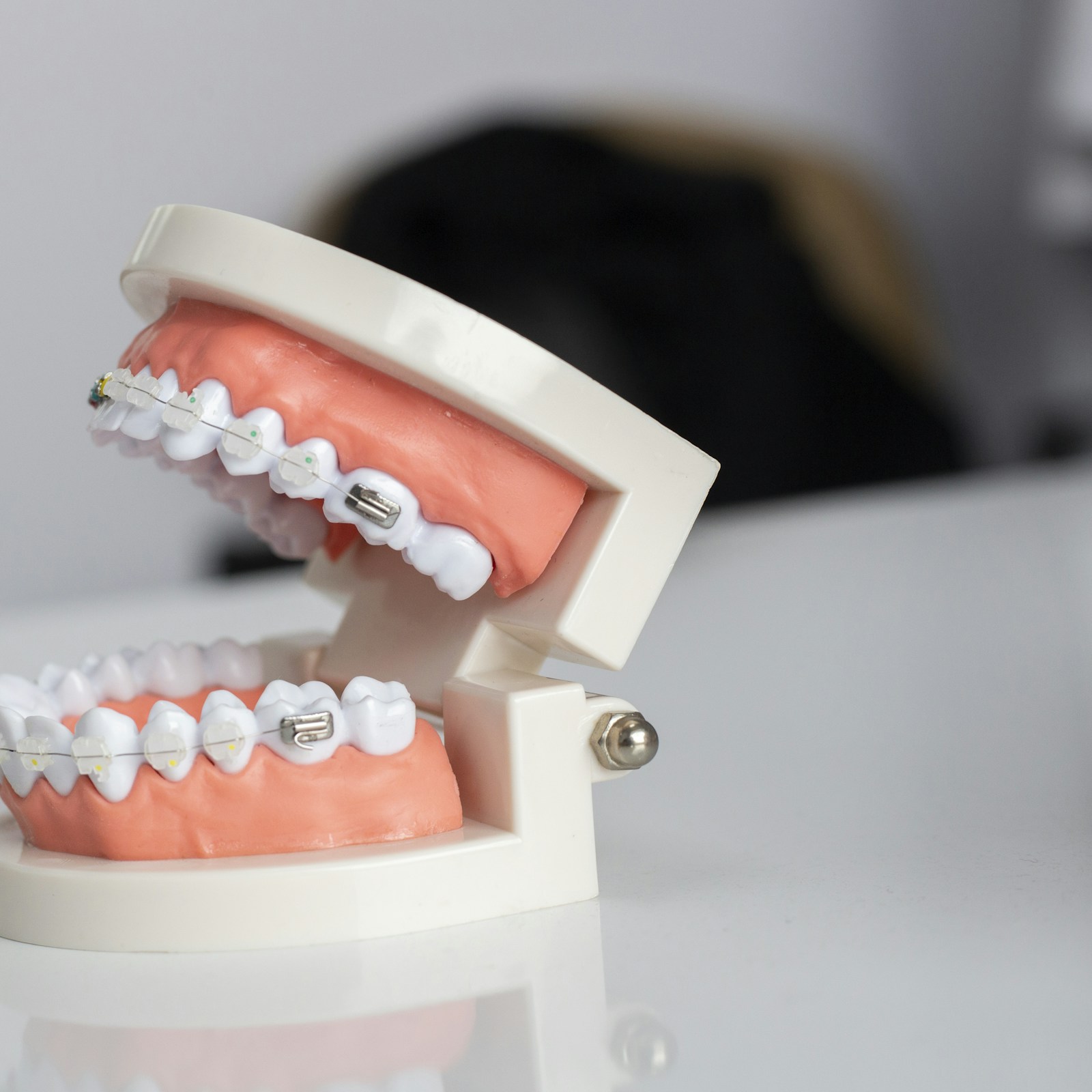 Dental Implants Antalya