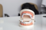 A dental model displaying a set of teeth with orthodontic braces on both the upper and lower jaws. The model is positioned on a glossy white surface with a blurred background. Soft lighting highlights the dental features.