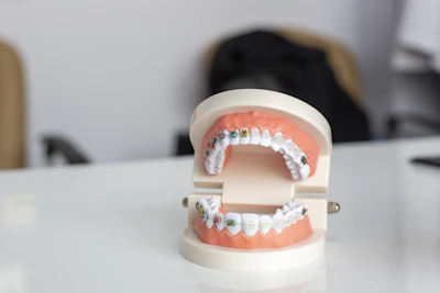 A durable bite splint molded perfectly to a dental model under bright lighting