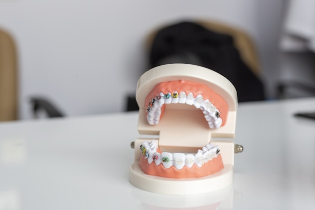 A dental model displaying a set of teeth with orthodontic braces on both the upper and lower jaws. The model is positioned on a glossy white surface with a blurred background. Soft lighting highlights the dental features.