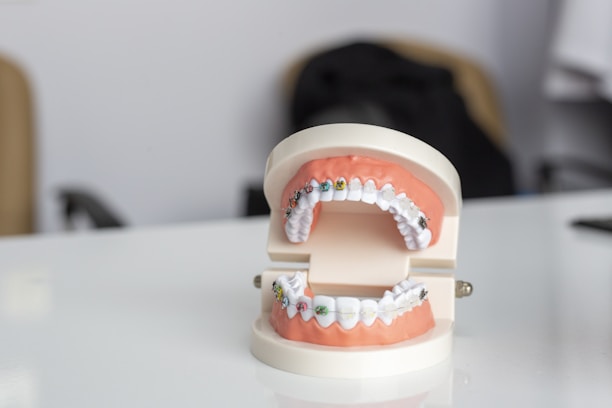 A dental model displaying a set of teeth with orthodontic braces on both the upper and lower jaws. The model is positioned on a glossy white surface with a blurred background. Soft lighting highlights the dental features.