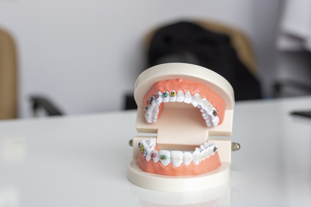A photo showing a dental model with braces.