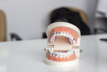A dental model displaying a set of teeth with orthodontic braces on both the upper and lower jaws. The model is positioned on a glossy white surface with a blurred background. Soft lighting highlights the dental features.
