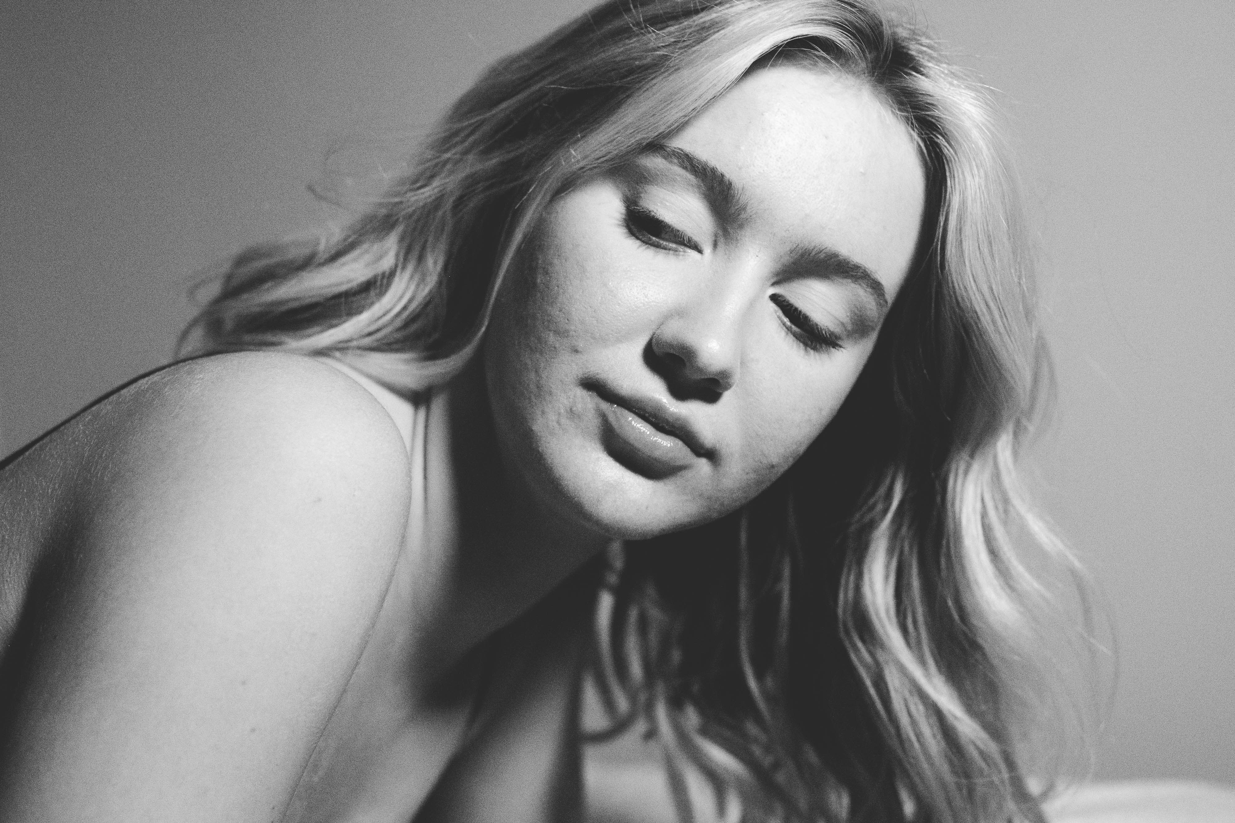 What You Need to Know About Fungal Acne and Benzoyl Peroxide