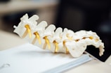 A detailed model of a human spine displayed on a surface, with yellow segments representing nerves.