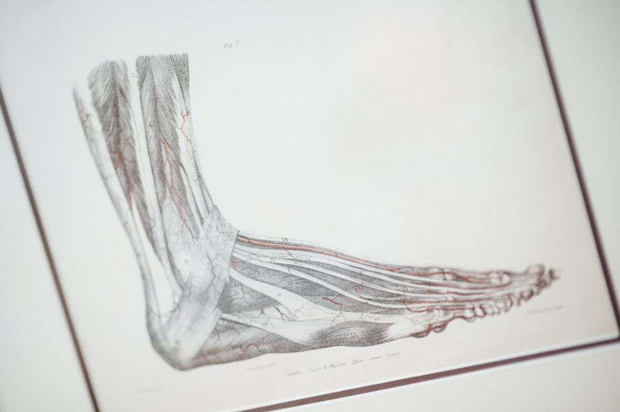 Pes Equinovarus, Metatarsus Varus, Talovalgus i Pes Planus: Kompletan Vodič za Dijagnozu i Lečenje Deformiteta Stopala