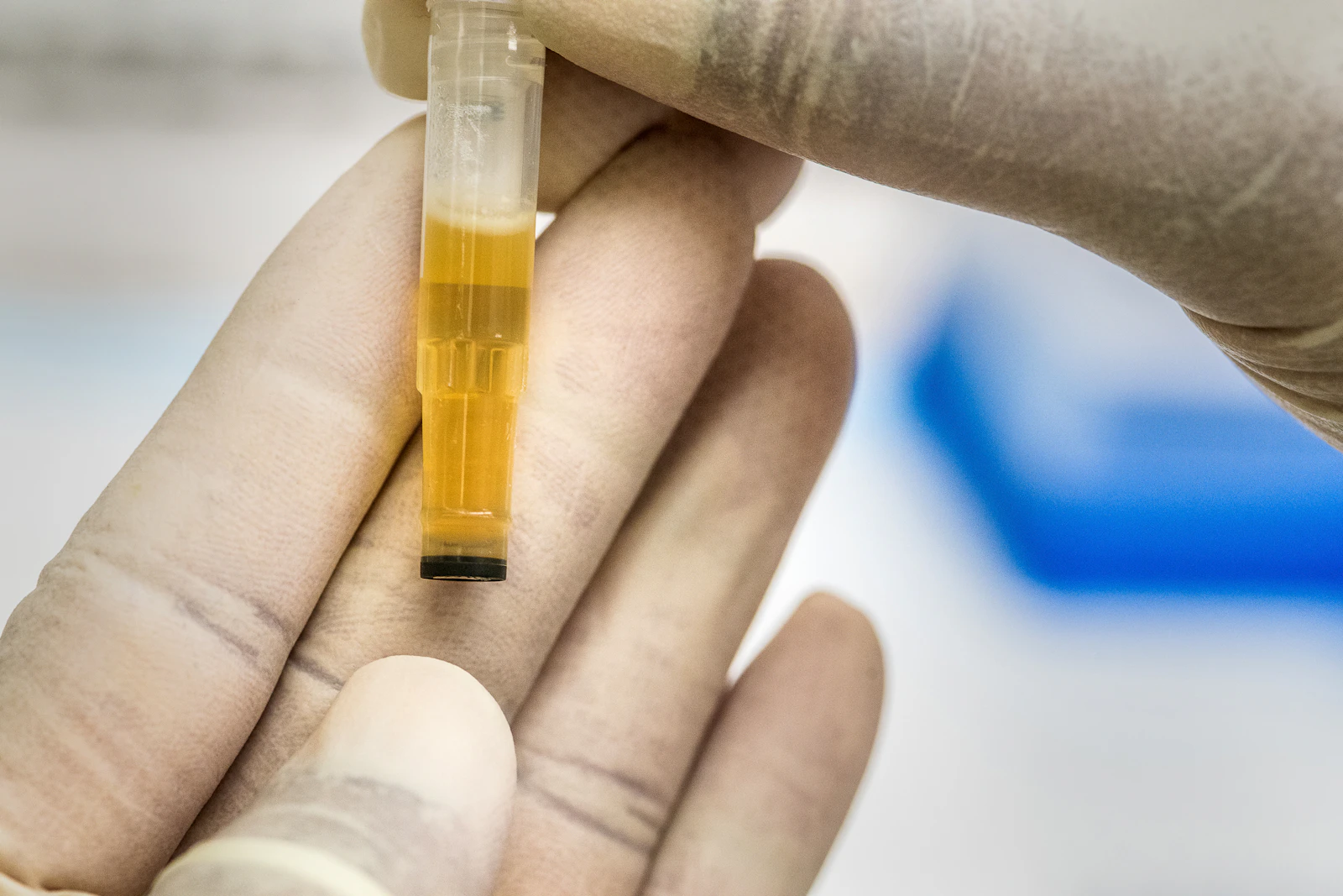 A gloved hand holding a urine sample tube