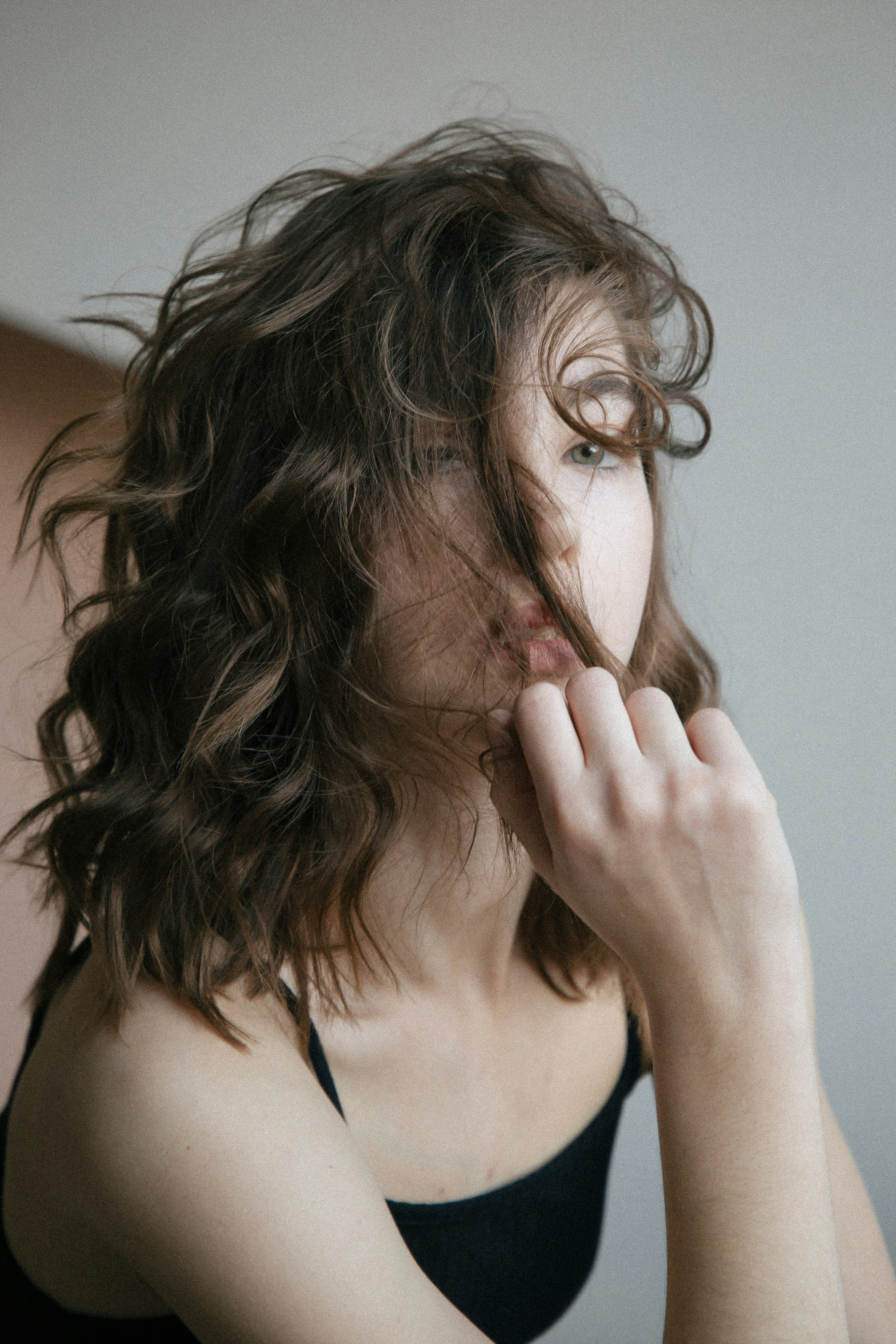 a young woman with female pattern baldness