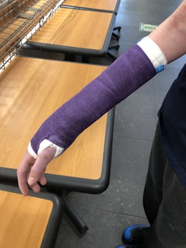 A person has their arm in a purple cast, extending from the hand to the elbow. They are standing near a wooden table.