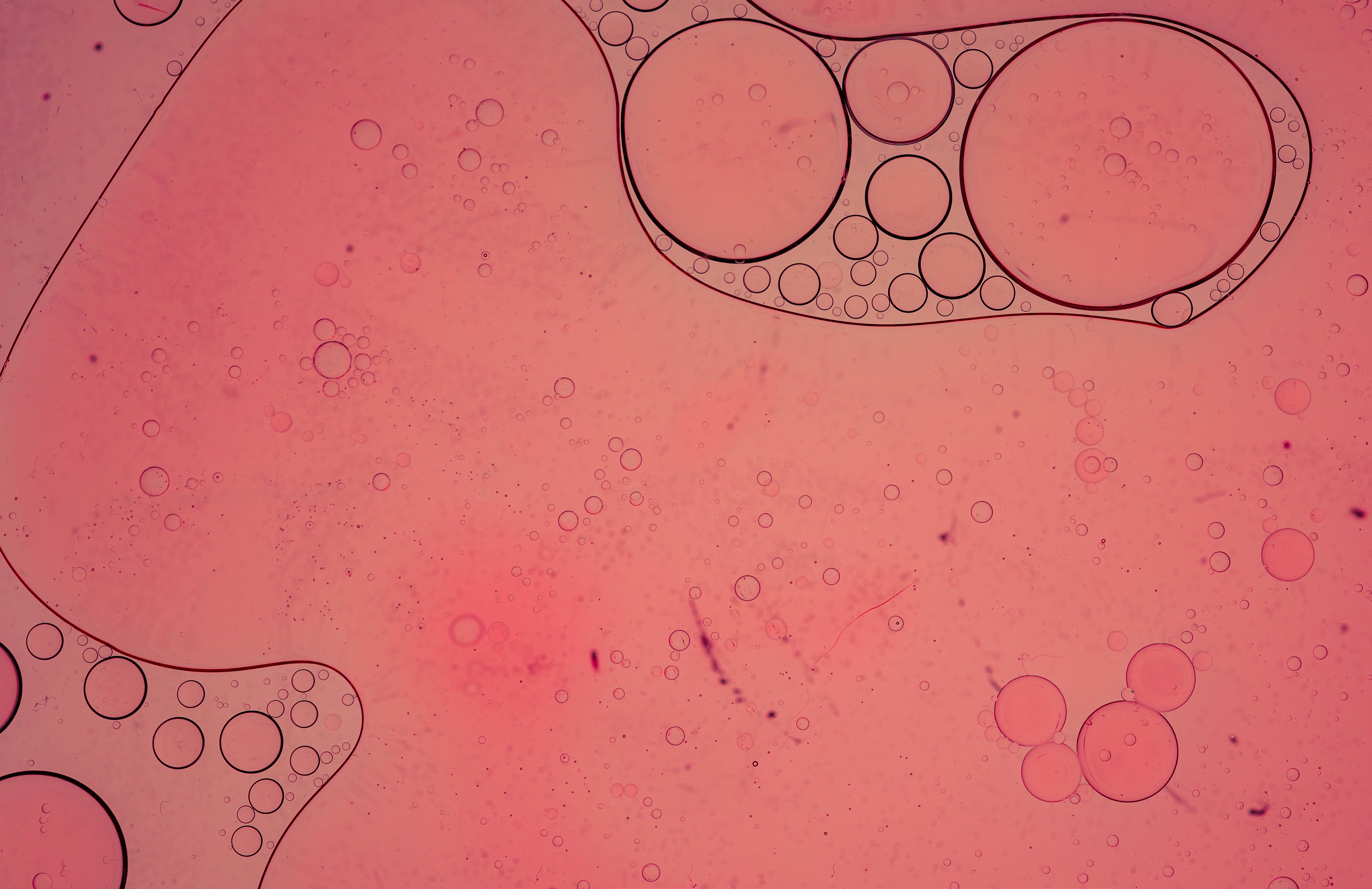 How Hormones May Influence Oxalate Sensitivity