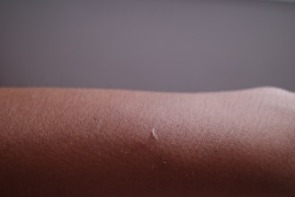 Close-up of smooth, radiant underarm skin after treatment.