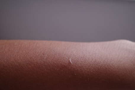 Close-up of a man's smooth skin after laser hair removal, highlighting clear, hair-free results.