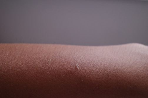 Close-up photo of smooth, hair-free skin after laser hair removal treatment