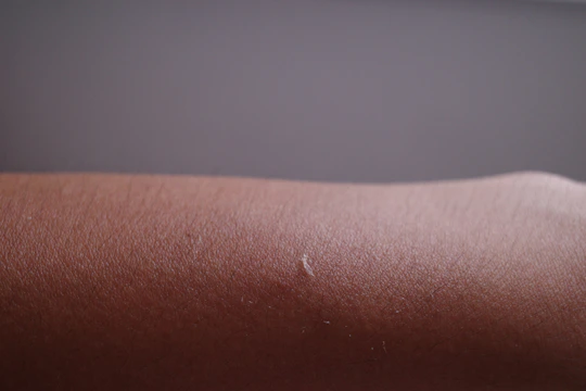 Close-up of a forearm showing subtle scar camouflage with natural skin tones.