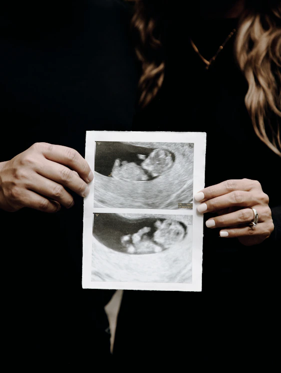woman holding a picture of a man