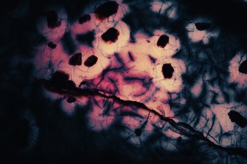 A close-up view resembling a microscopic or abstract biological pattern, featuring dark irregular shapes scattered across a softly lit background with intricate lines and veils. The image presents a striking contrast between deep black, dark brown, and vivid patches of pink and purple hues.