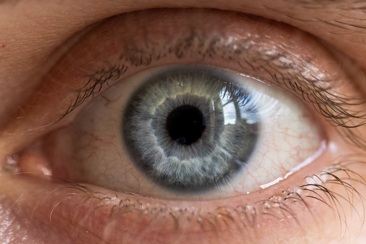 SpyGlass Pharma (SGP) adds four-year evidence for its glaucoma implant
