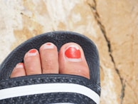 A close-up view of toes with chipped red nail polish, wearing a black sandal with white stripes, set against a textured stone background.