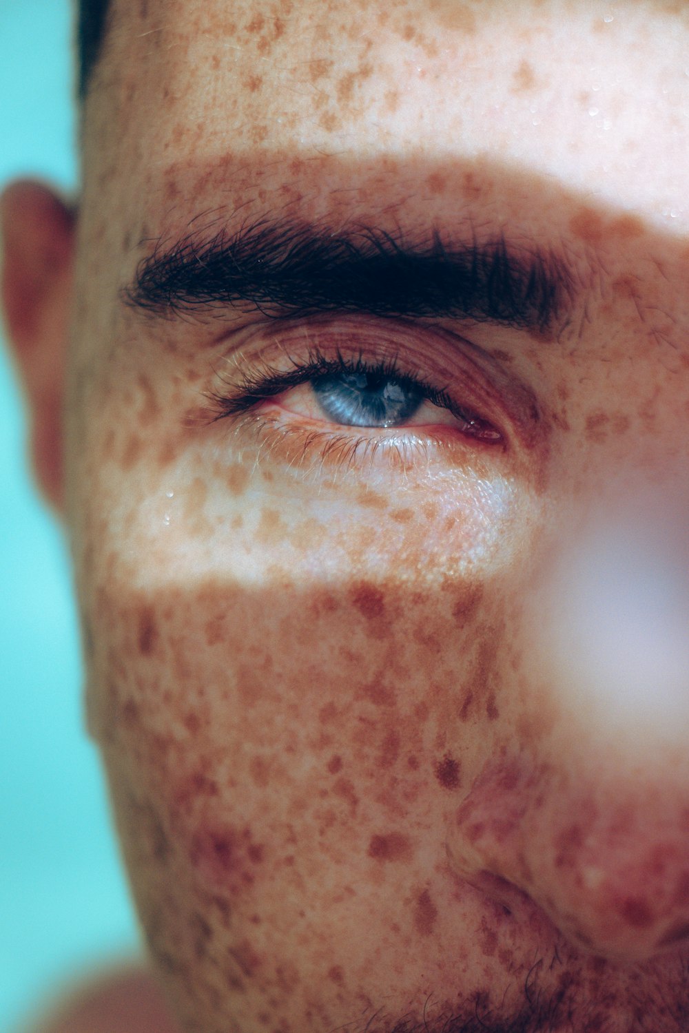 persons eye with brown liquid