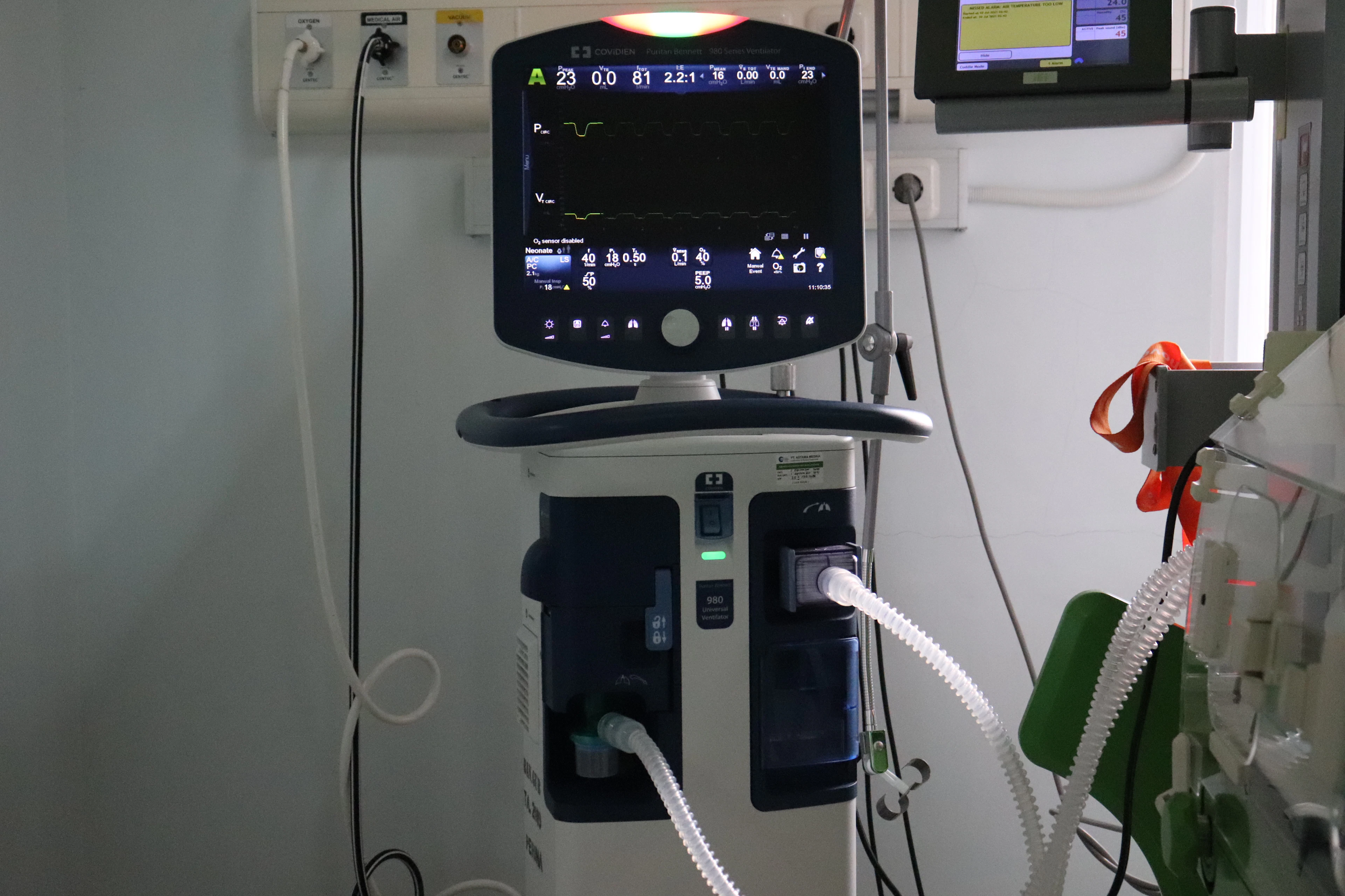 Close-up of a medical monitoring device display