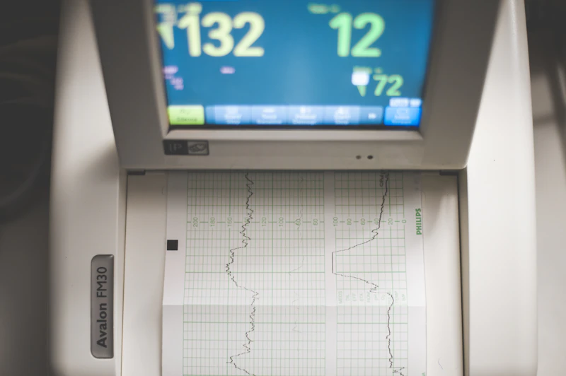 Electrocardiograma