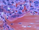 A close-up of a histological slide showing a section of tissue with various cell structures. The image is rich in texture with bright reds, purples, and blues indicating different cellular components.