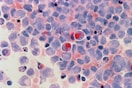 red round fruits on white and blue surface