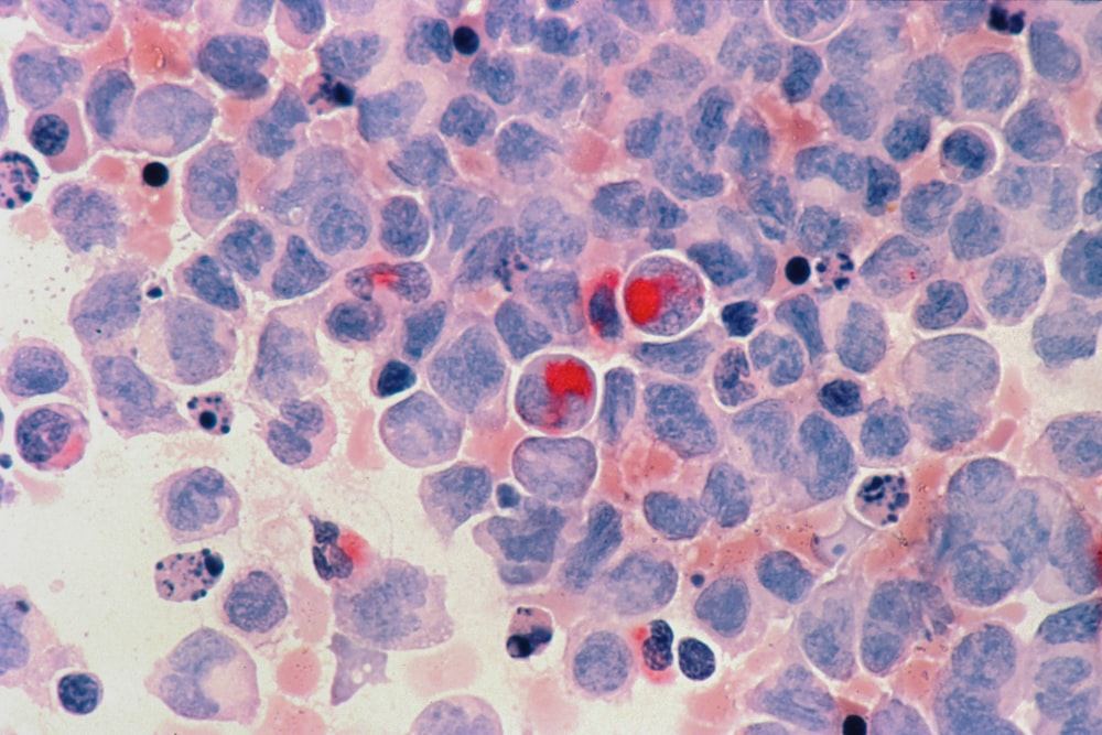 red round fruits on white and blue surface