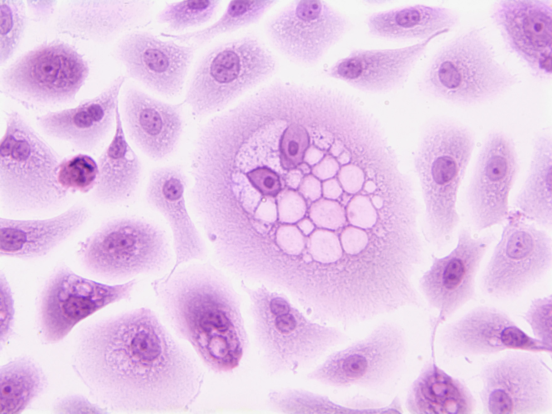 National Cancer Institute / Unsplash