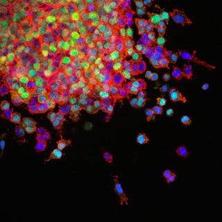 A microscopic image showcasing a cluster of cells. The cells are vibrant with green, red, and blue fluorescence, indicating various staining or molecular labeling. The majority of the cells are tightly packed in the upper portion, while fewer cells are scattered below against a dark background.