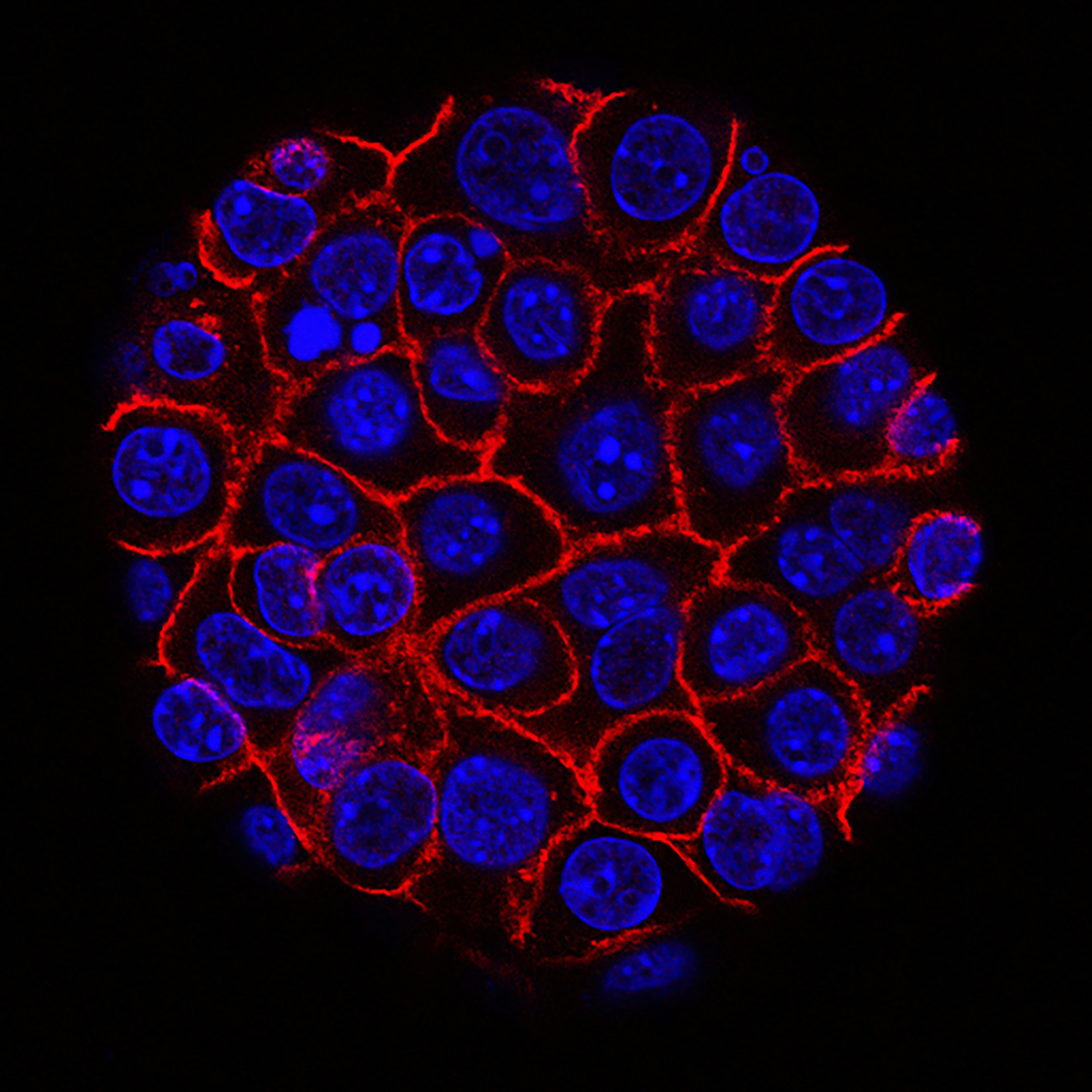 Mesenchymal Stem Cells Therapy