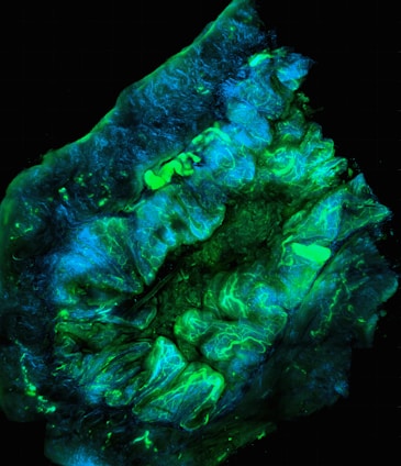 A microscopic image of a biological tissue sample, showing intricate and detailed structures in vibrant colors. The tissue appears to be illuminated with fluorescent staining, showcasing branching patterns and areas of varying intensity in green and blue hues.