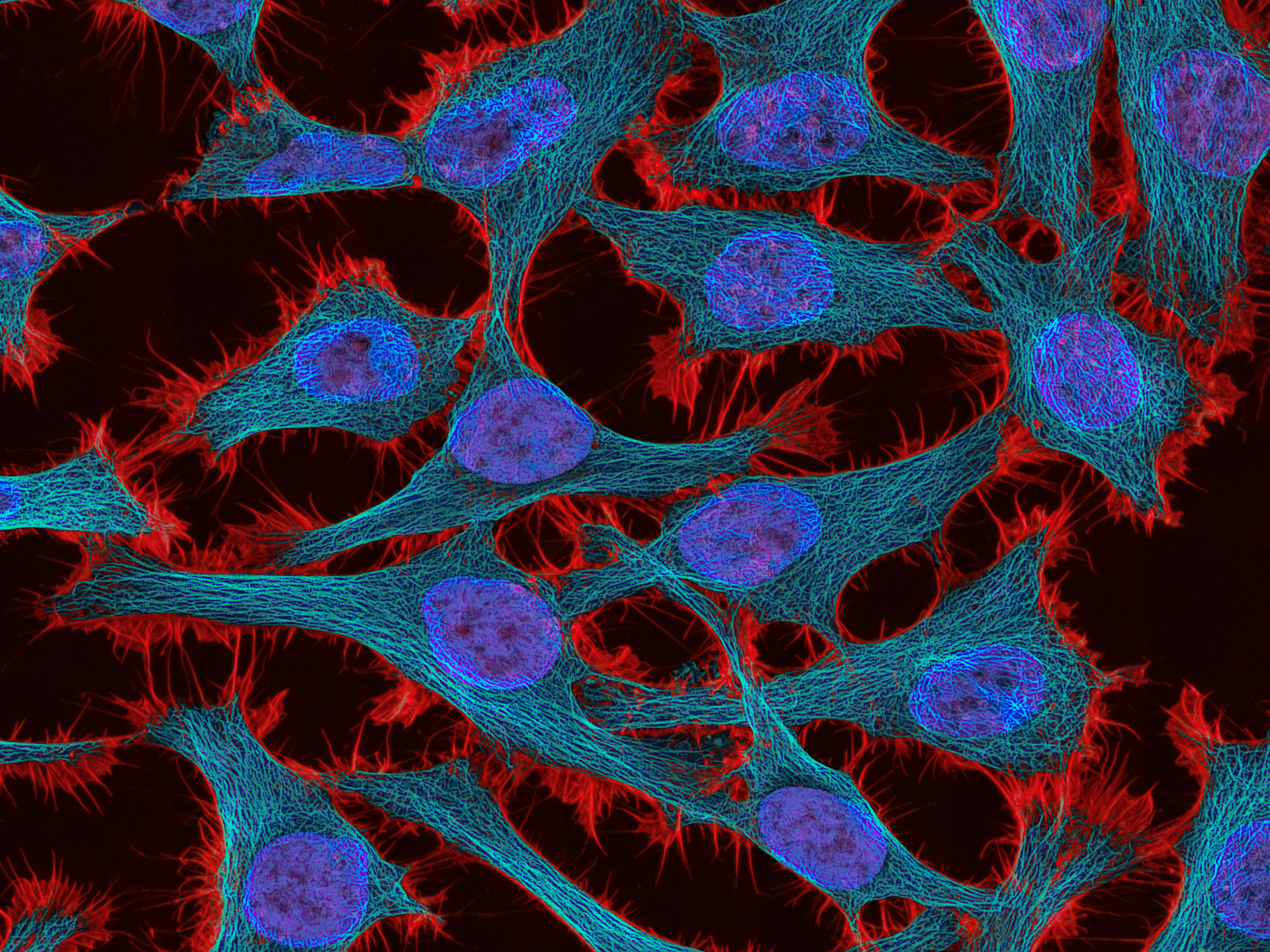 Your Brain on Color: The Neuroscience That Makes Psychedelic Art Impossible to Ignore