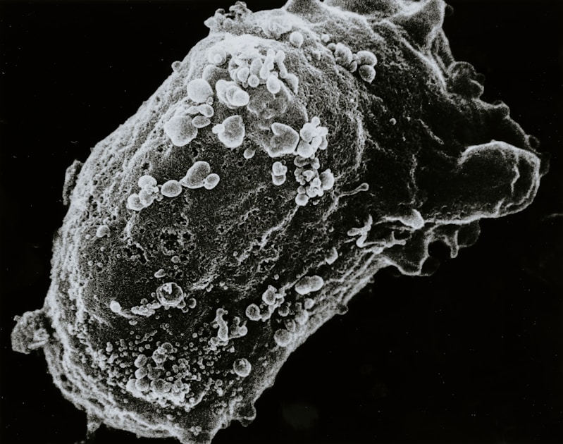 Brain-Eating Amoeba: Scientists Warn of Global Spread as Climate Warms Water Systems