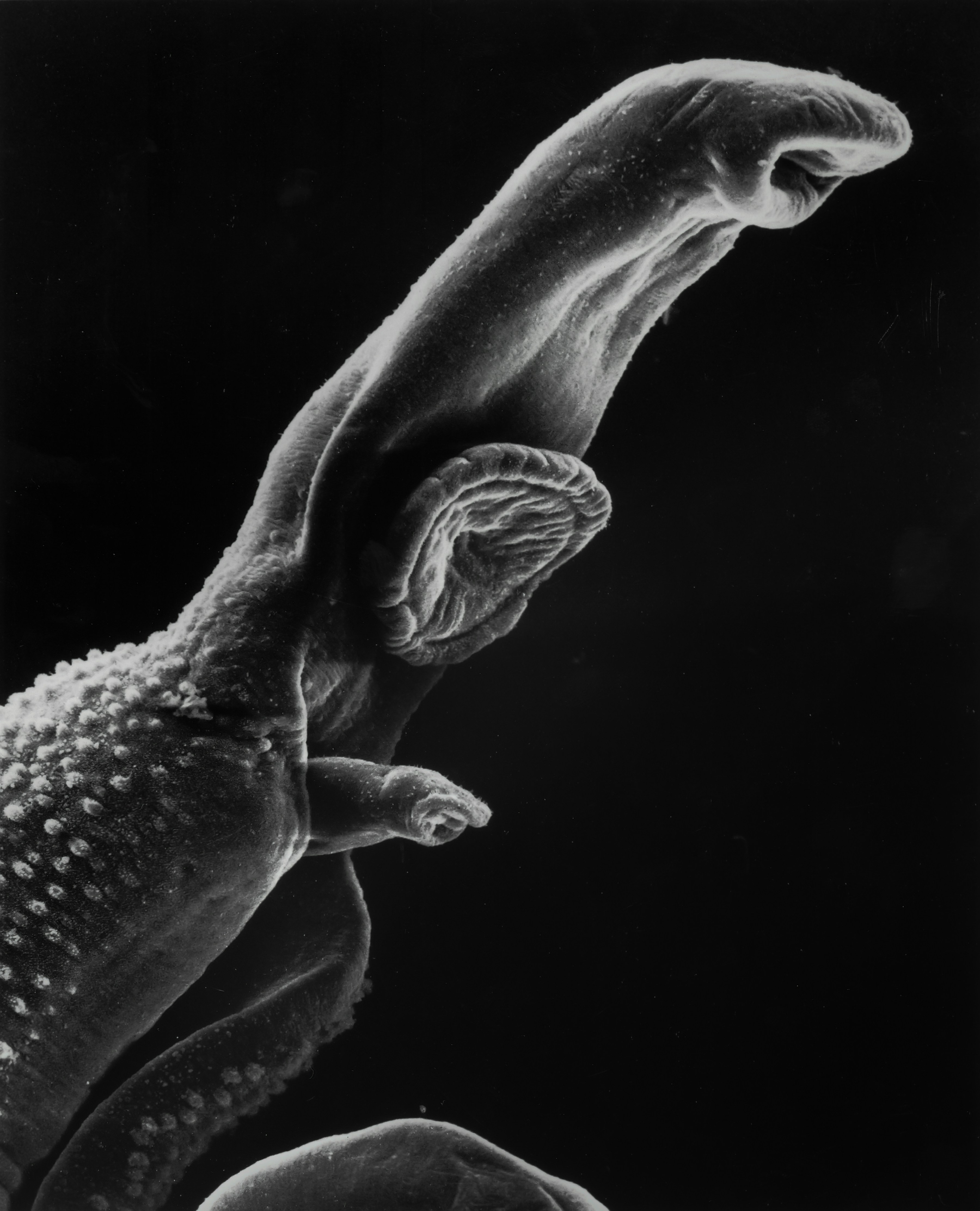 Scanning electron micrograph of a schistosome parasite, which enters the body through the skin of persons coming in contact with infested waters. The adult worm lives in the veins of its host. This parasite has been associated with some cancers. The parasite is magnified x256 in this photograph.