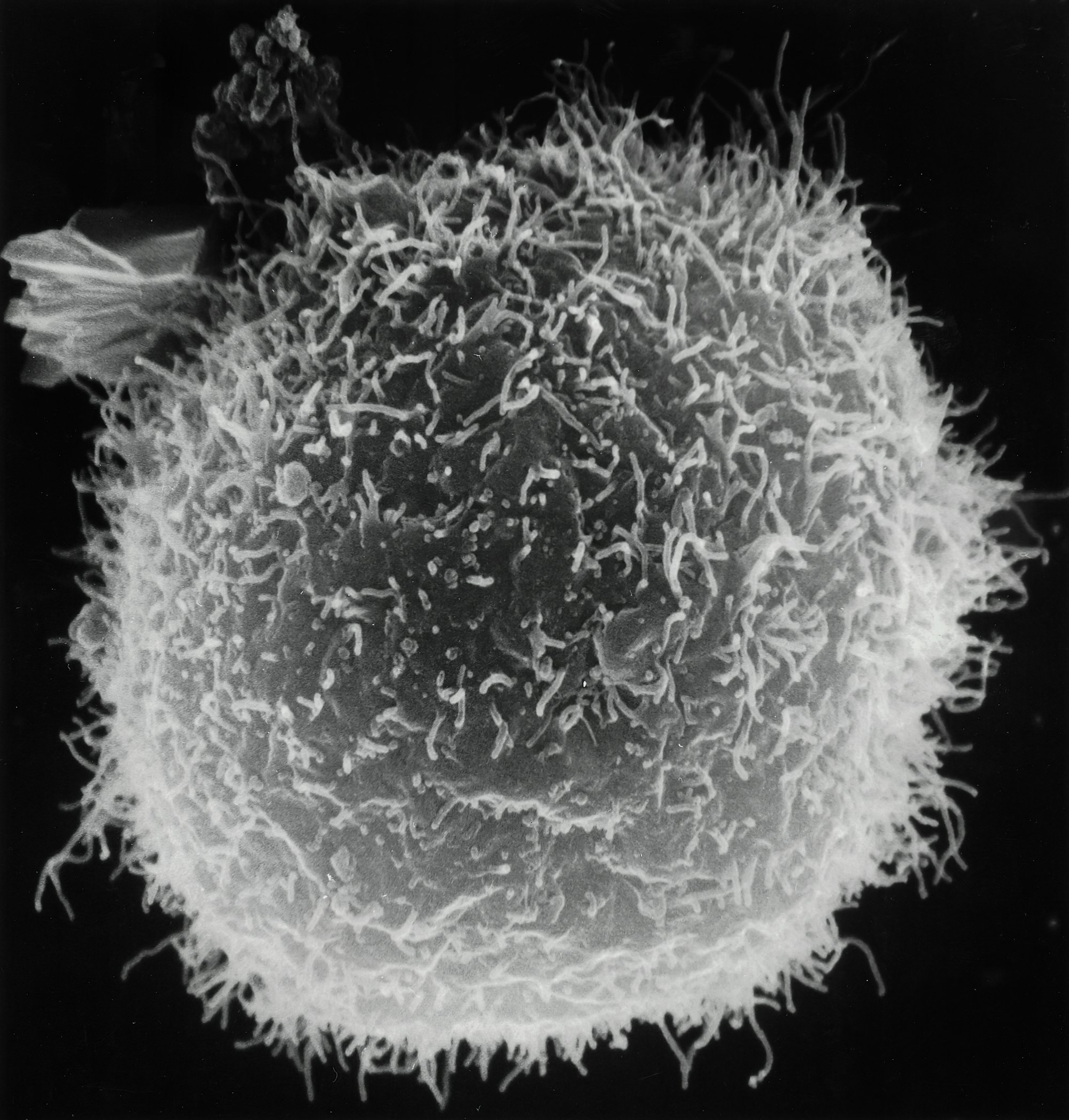 Scanning electron micrograph of macrophages with projectile-looking surfaces that are interacting with lymphocytes which are rounded.