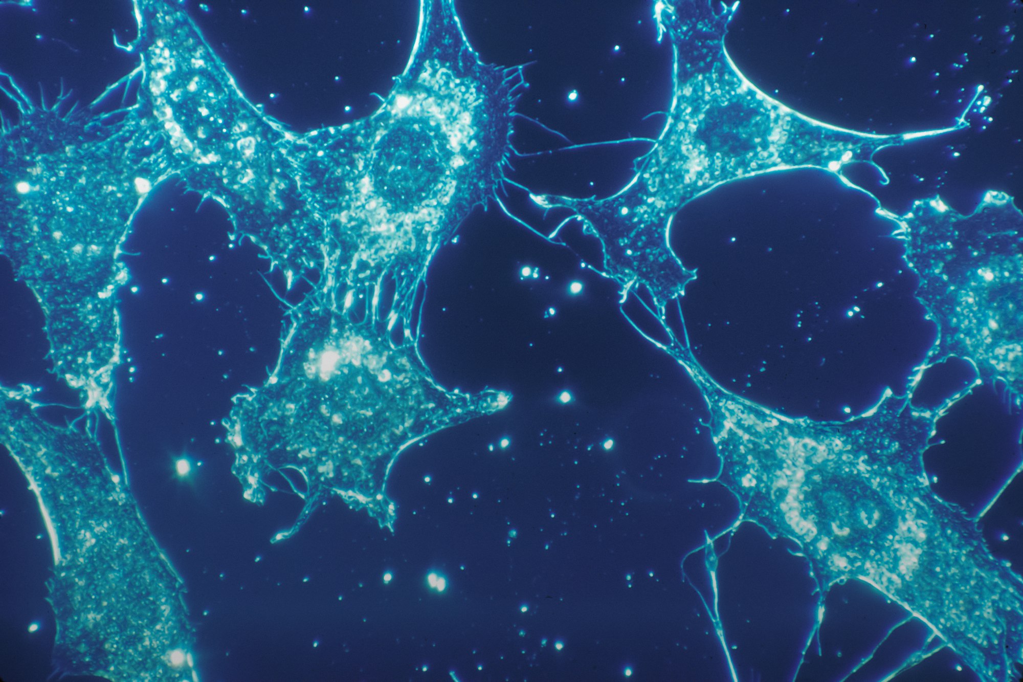 Normal cells of human connective tissue in culture at a magnification of 500x