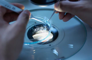 Egg Freezing